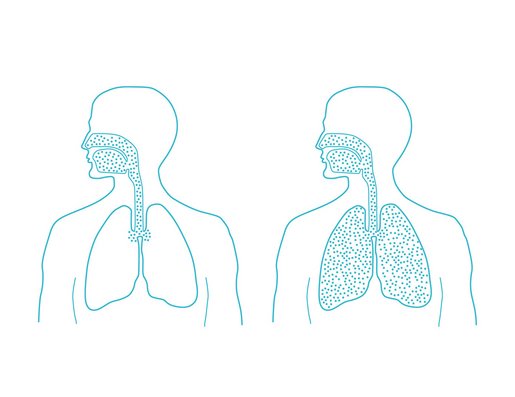 Microsalt dry salt inhalation